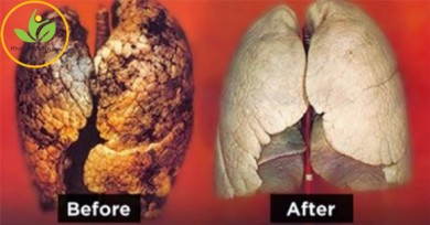 Nếu đã nghiện thuốc lá hãy dùng cách này để thanh lọc phổi