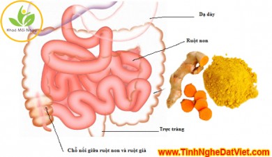 CHUYÊN GIA HƯỚNG DẪN CÁCH UỐNG TINH BỘT NGHỆ HIỆU QUẢ SAU KHI CẮT BỎ RUỘT NON