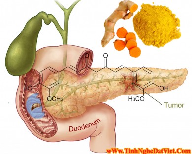 CURCUMIN TRONG TINH BỘT NGHỆ CÓ TÁC DỤNG BẢO VỆ VÀ PHÒNG CHỐNG UNG THƯ TUYẾN TỤY