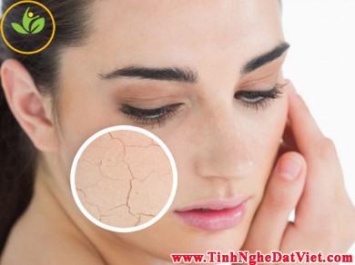 Da bạn khô - hãy yên tâm vì đã có tinh bột nghệ