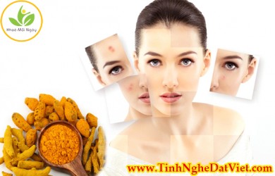 Nhờ tác dụng của tinh bột nghệ với da khiến cho bạn có 1 vẻ đẹp hoàn hảo